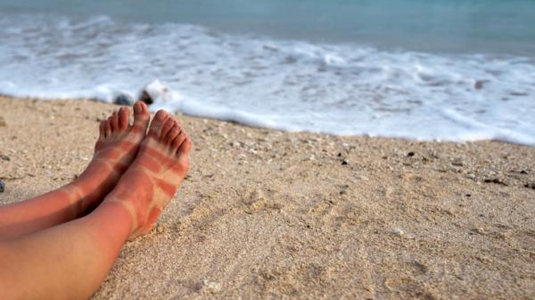 SunCool - Hladilni aloe vera gel